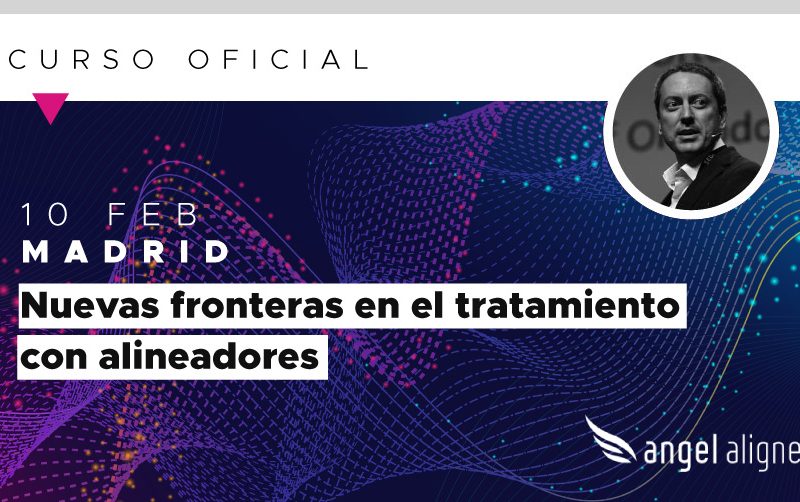 Angel-Aligner-Madrid