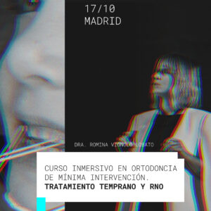 RNO